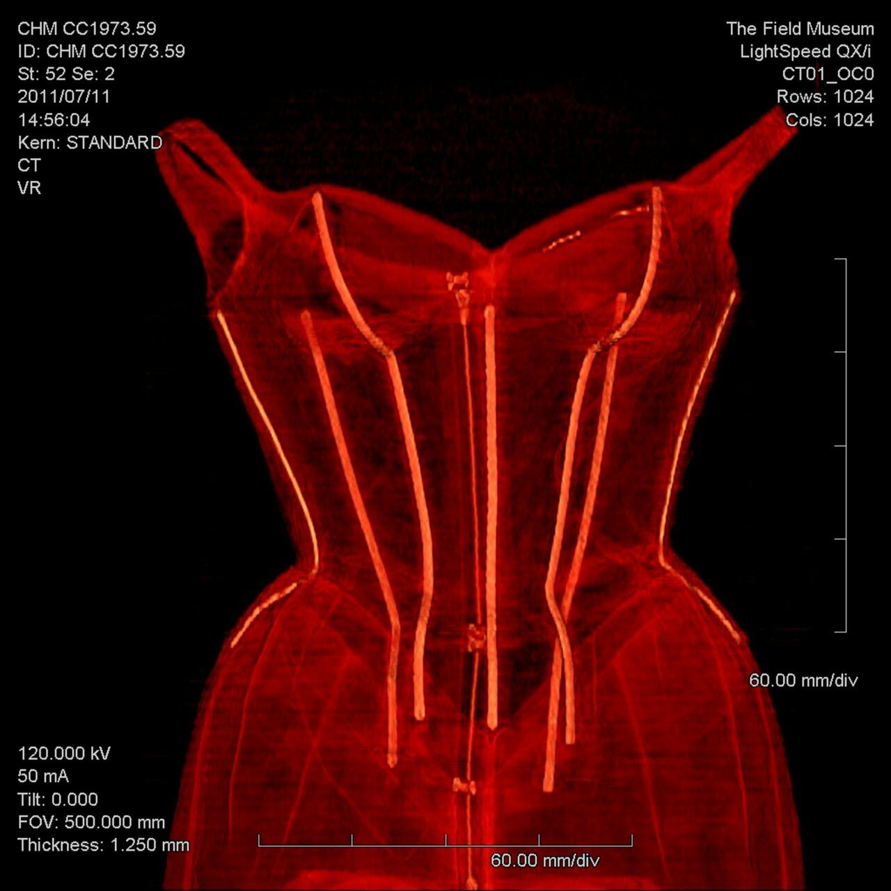 Exhibition-GAC-Charles James-tree ct scan